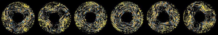 Васцилляция Хайда